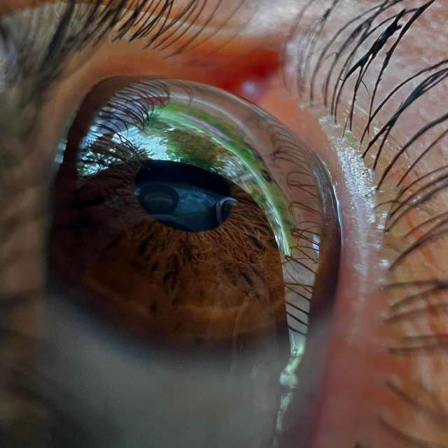 Weather forecasts with beautiful photos by BETOGONZALEZ